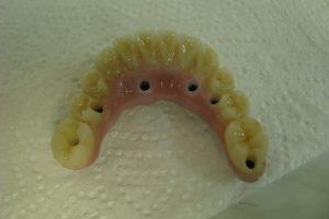 implantaty-08